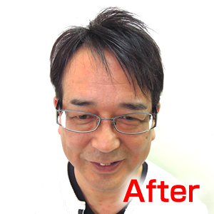 katura-after1