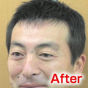 katura-after2
