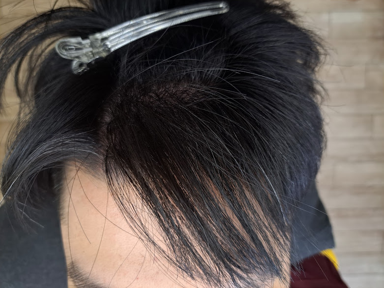 初めてのウイッグ、増毛のご相談時に注意する点。