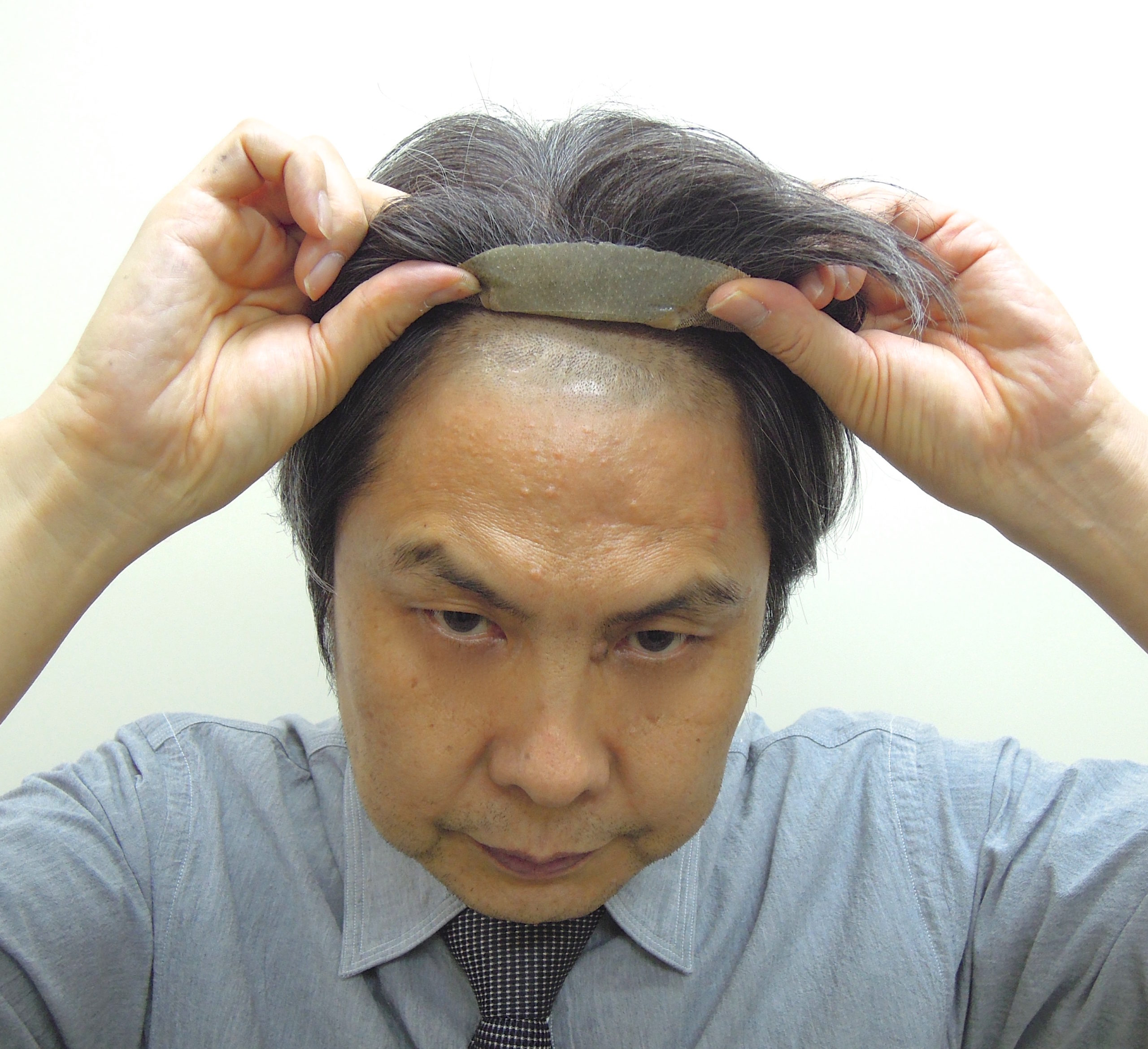 （動画）画期的痛くなくて強力に固定。新型ストッパーベース