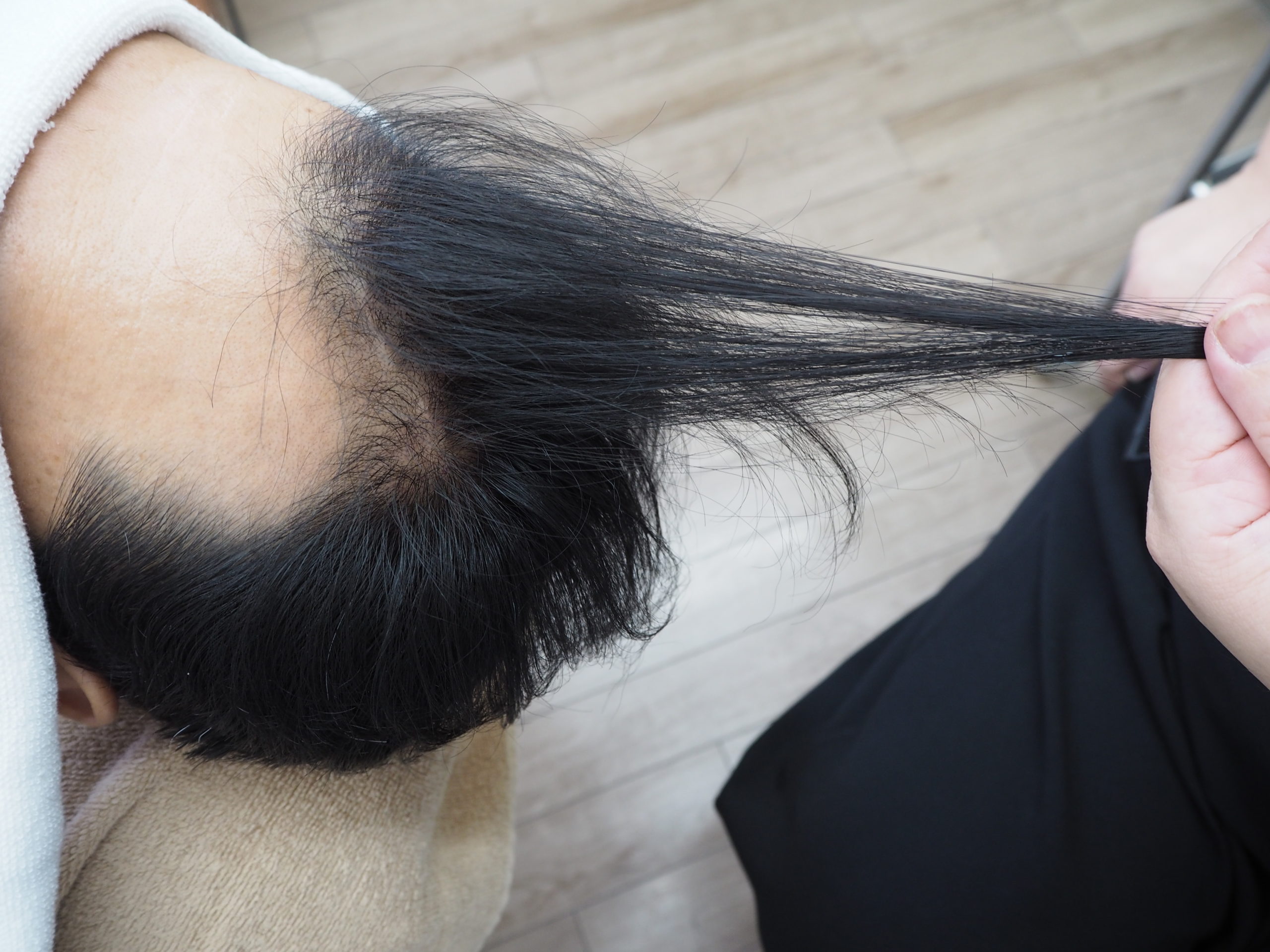 増毛は女性の方が積極的です。（動画）