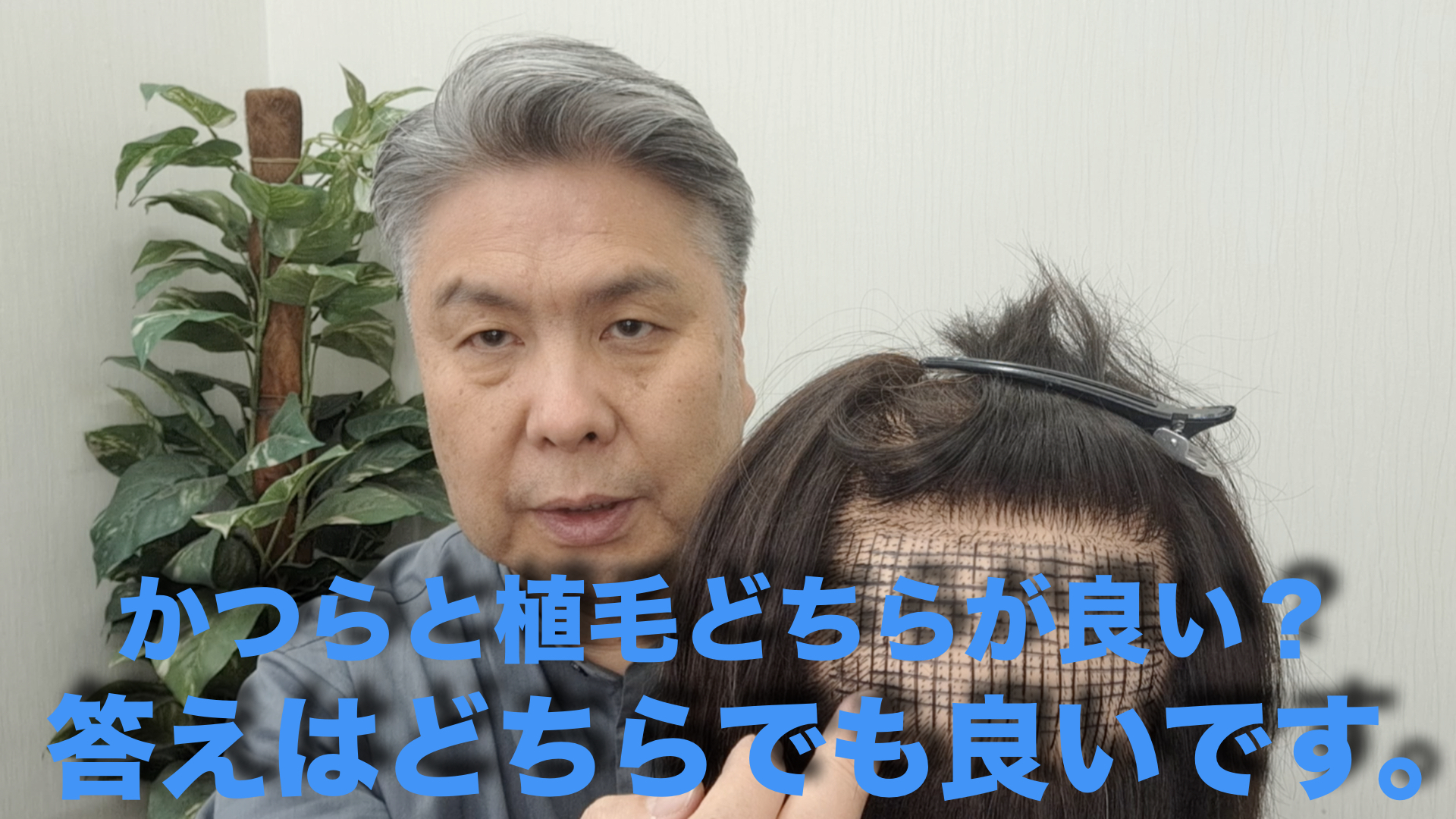 （動画）かつらと植毛どちらが？本音とたてまえ。