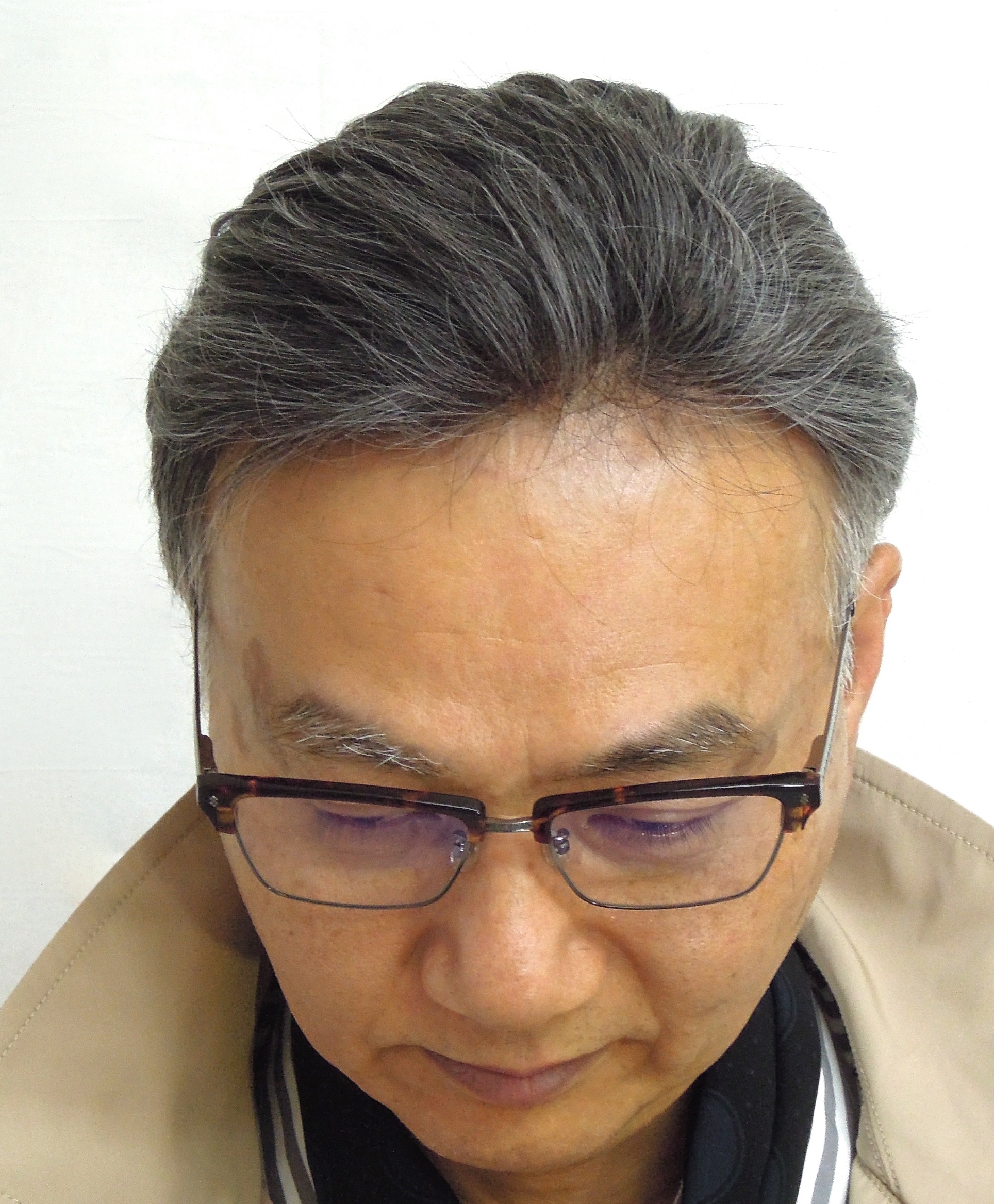 髪を増やす時に眼鏡をかけてみると。