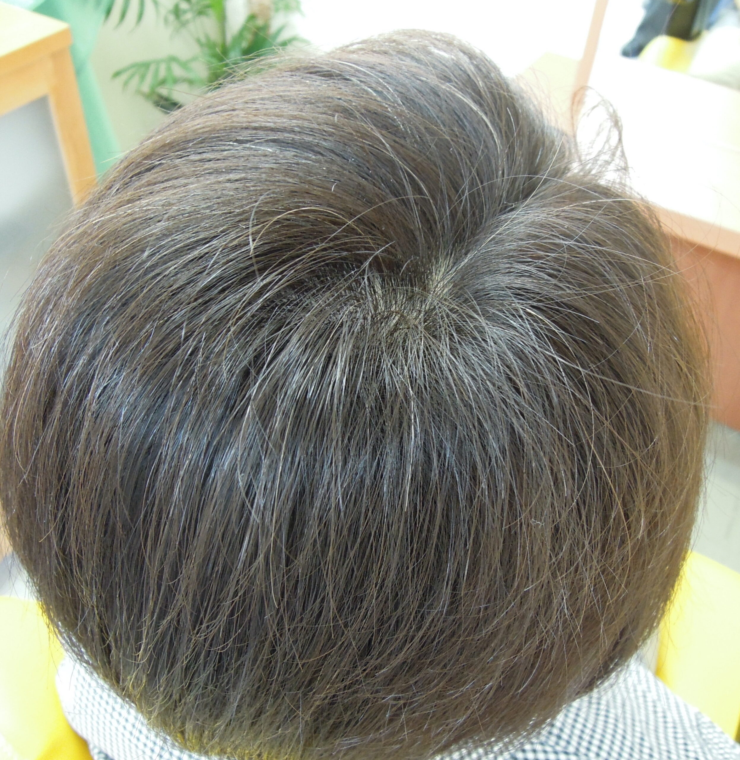 初めて増毛された感想。（youtube)